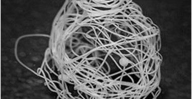 Ovillo de seda artificial confeccionada por los investigadores / Foto: Universidad de Ciencias Agrarias (Suecia)