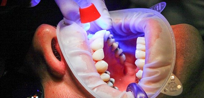 Intervención bucal en un dentista / Foto: Pixabay