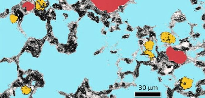 Visualización de nanopartículas de oro (en amarillo) en el pulmón de ratones que las han inhalado / Foto: Mark Miller