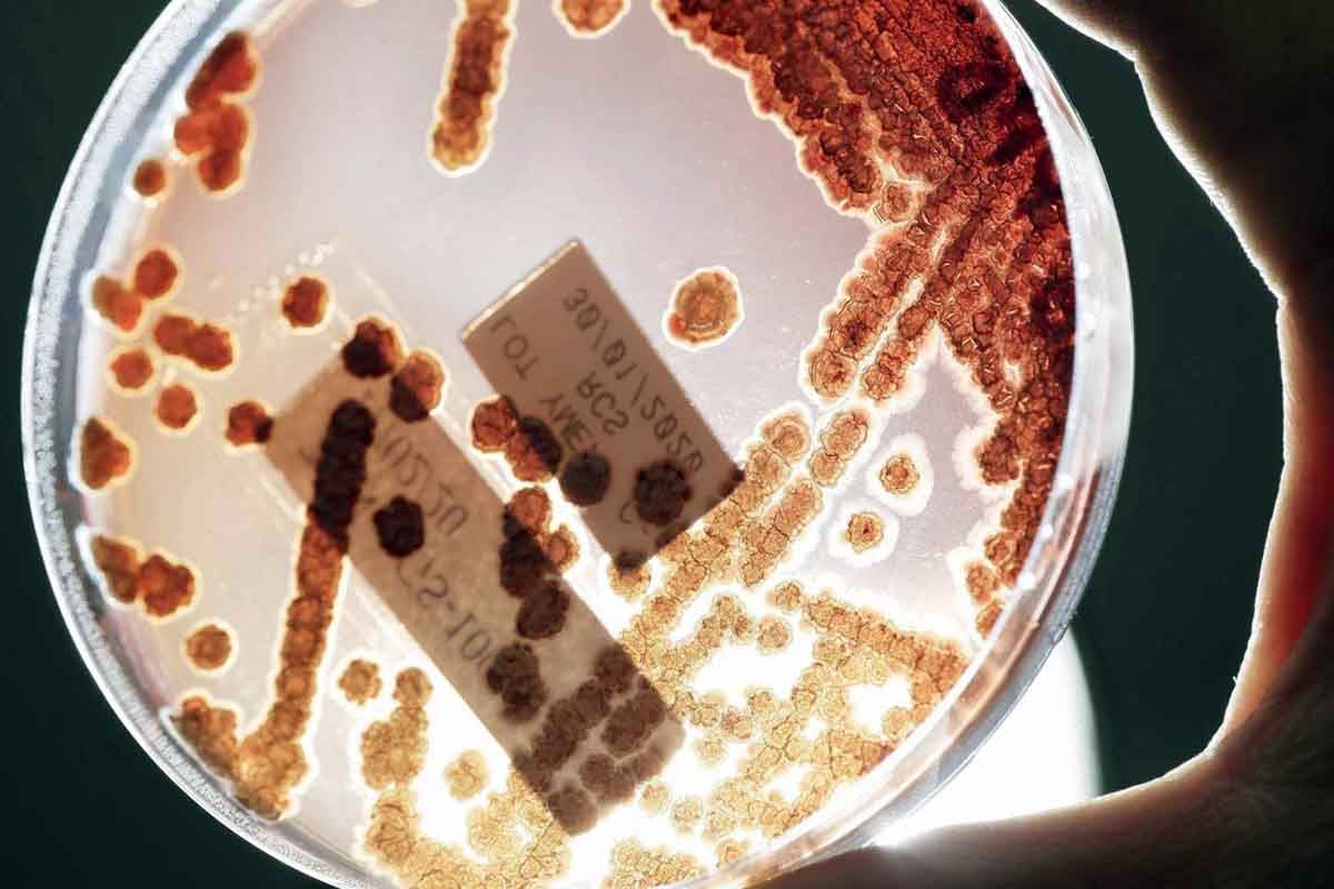 Cerca de 1,27 millones de personas murieron en 2019 en el mundo por infecciones bacterianas comunes que se han convertido en resistentes a los antibióticos, indica un estudio publicado este jueves por The Lancet / Foto: Jeffrey Arguedas - EFE - SINC