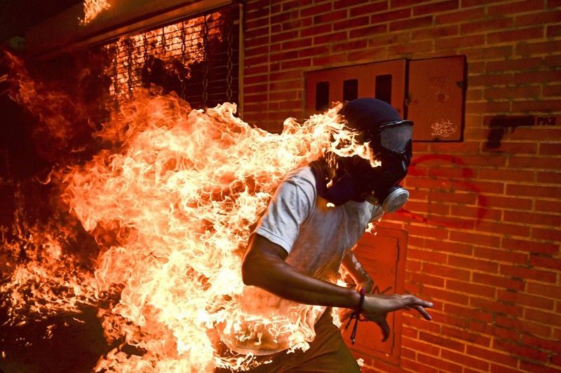 Crisis de Venezuela. Foto de prensa mundial del año. José Víctor Salazar Balza (28) incendiado en los violentos enfrentamientos con la policía en una protesta contra el presidente Nicolás Maduro / Foto: Ronaldo Schemidt (Venezuela)