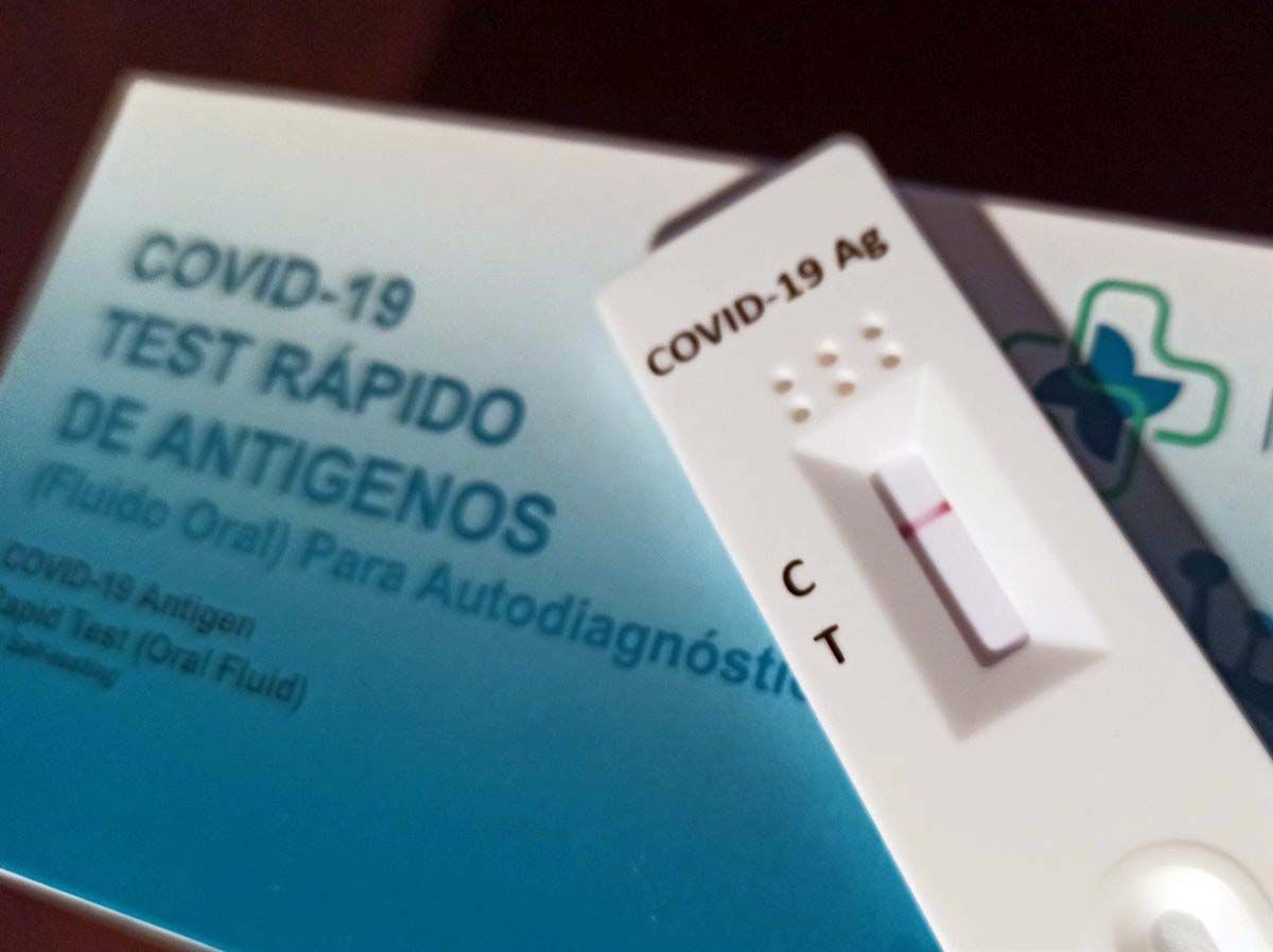 Test de antígenos. España suma 48.272 casos y 243 muertes con COVID-19 / Foto: EP