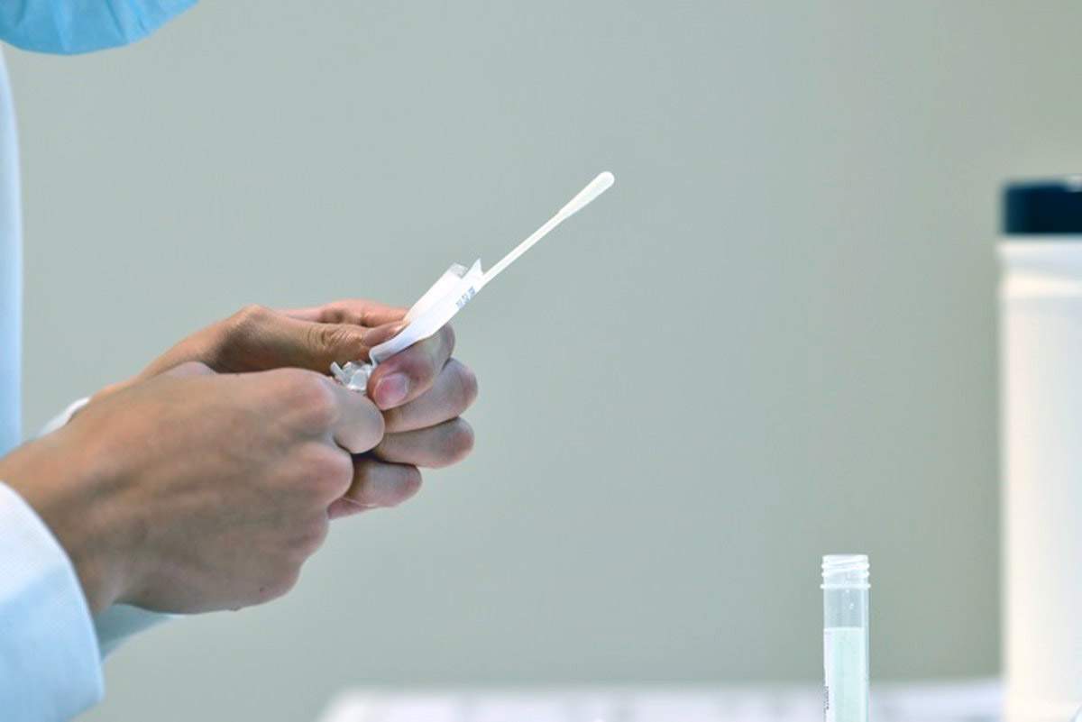 Prueba de RT PCR para la infección por SARS CoV 2, COVID-19 / Foto: EP