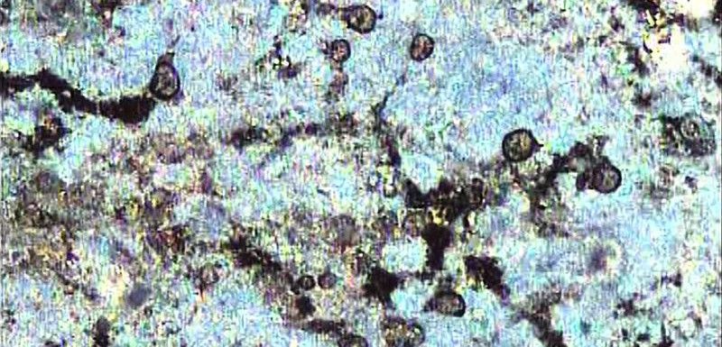 Imagen ambiental de las amebas de la placa bacteriana que daña la dentadura / Foto: Wikipedia