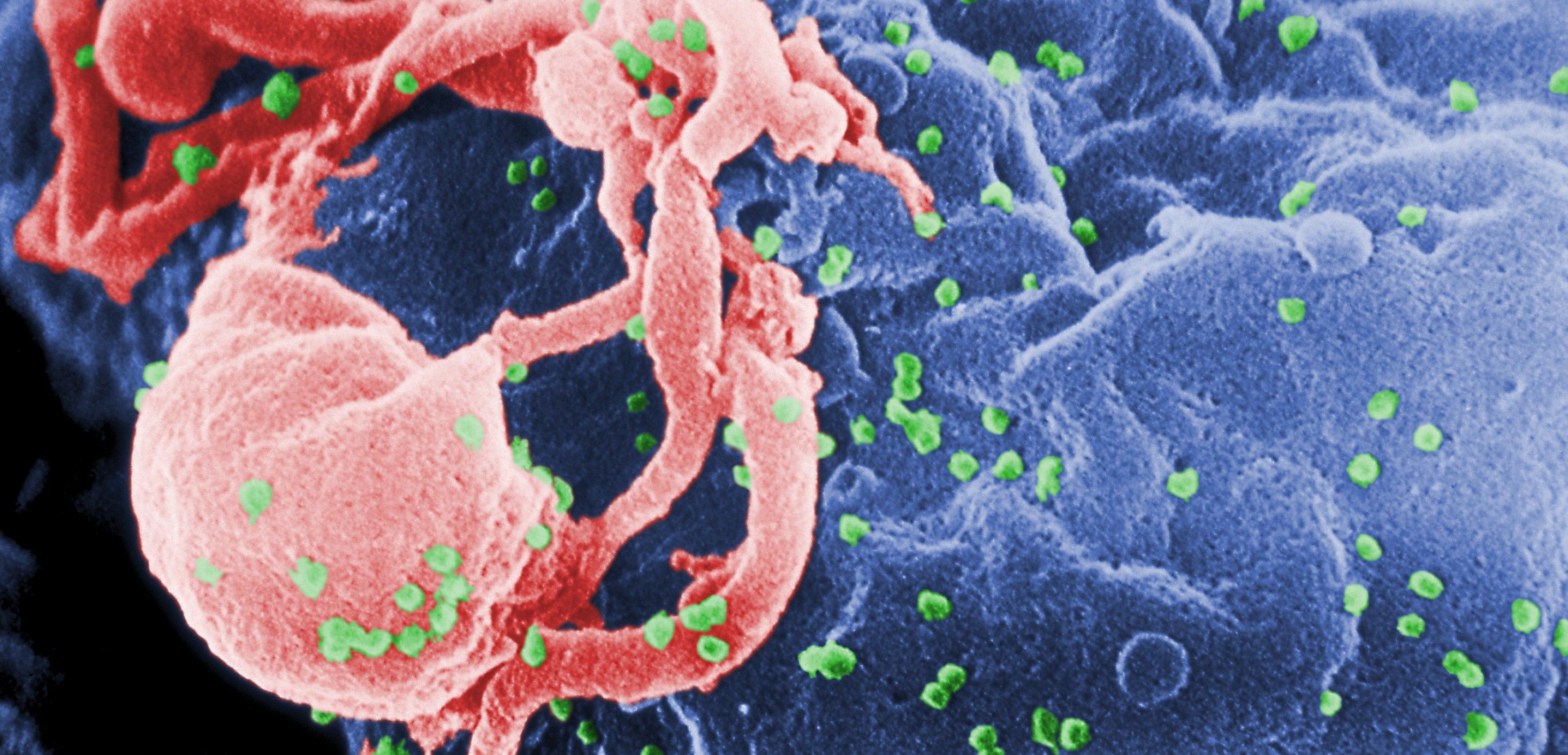 El virus tiene una gran capacidad para resistir oculto en las células humanas / Foto: Wikipedia
