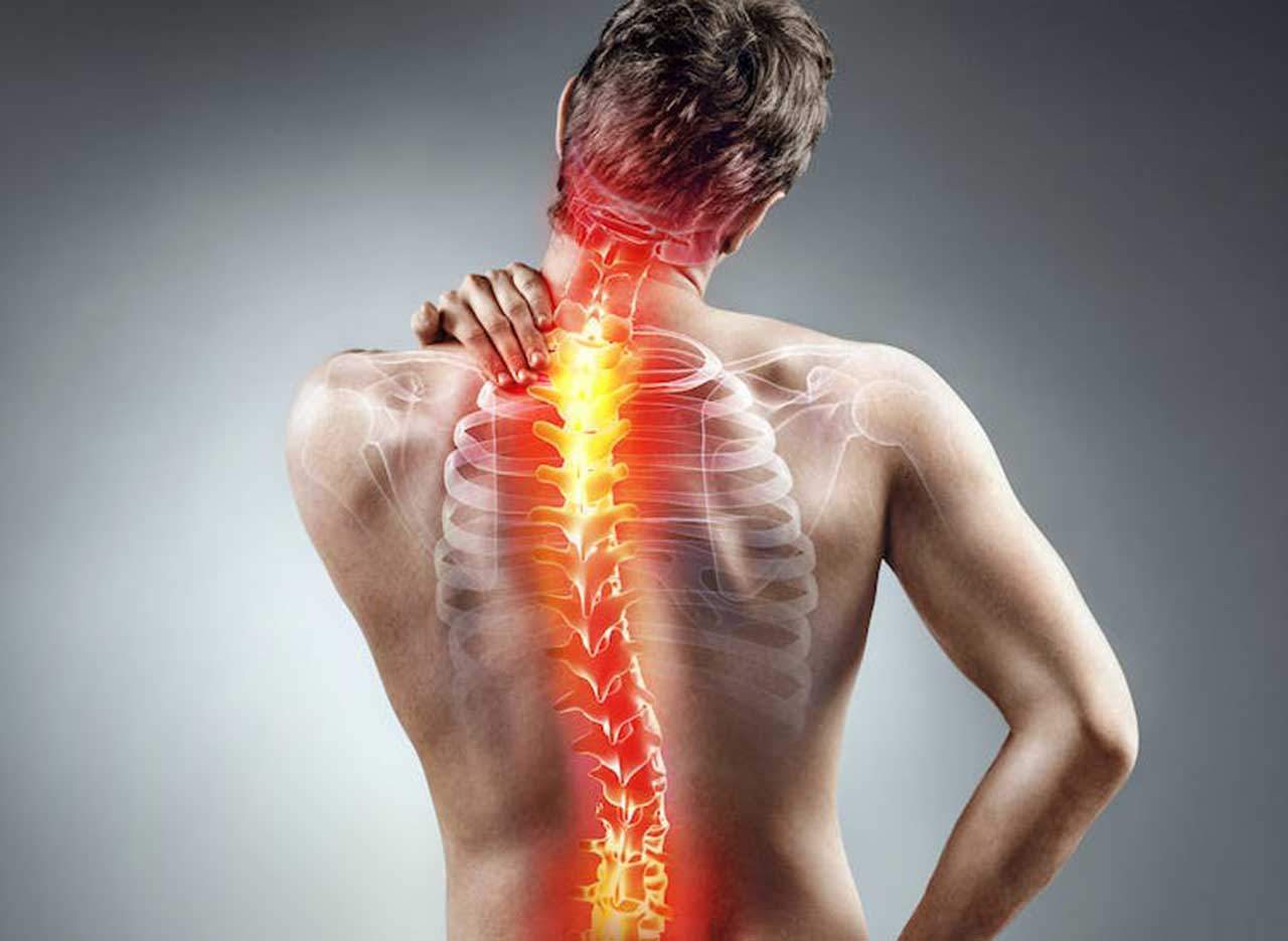 El dolor de espalda afecta a más del 80 % de la población, en algún momento de nuestra vida / Foto: The Conversation