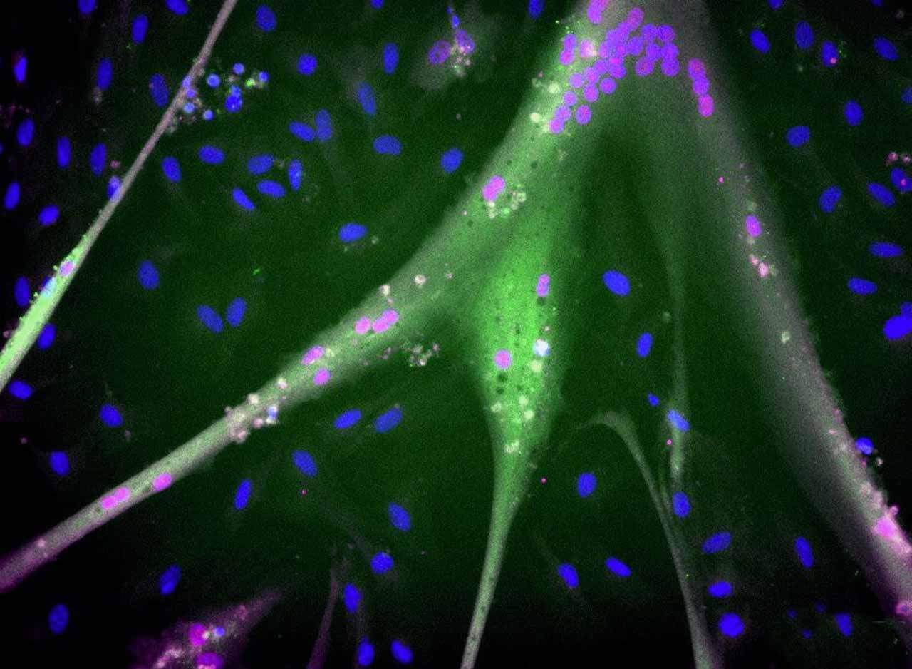 Células madre bovinas inmortalizadas diferenciadas con proteínas musculares totalmente expresadas (azul = núcleos; magenta = miogenina; verde = miosina).  Producir carne en masa con células madre inmortales / Imagen: EP