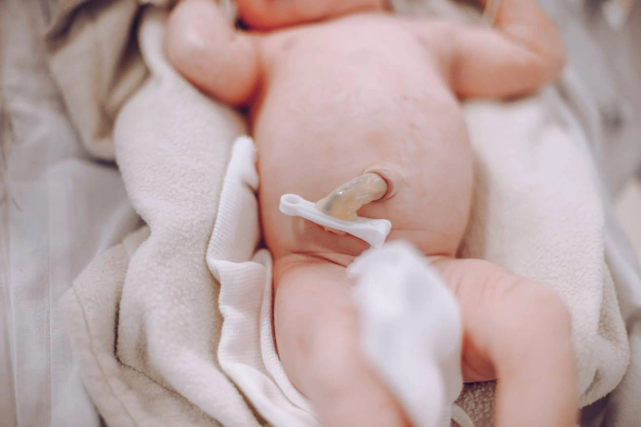 Detectan 11 compuestos químicos en la sangre del cordón umbilical de 69 bebés / Foto: SINC