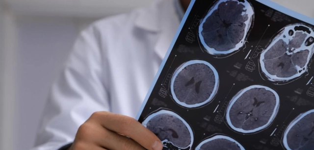The AEI allocates 31 million to projects against Alzheimer’s