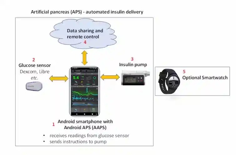 Elementos de un páncreas artificial de código libre. AndroidAPS Community Elementos de un páncreas artificial de código libre. AndroidAPS Community