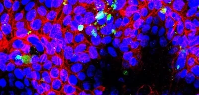 Las imágenes de microscopía muestran la capacidad de los nanoplásticos para interactuar con las células intestinales Las imágenes de microscopía muestran la capacidad de los nanoplásticos para interactuar con las células intestinales