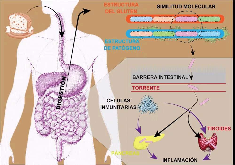 Representación del mimetismo molecular en las enfermedades autoinmunes Representación del mimetismo molecular en las enfermedades autoinmunes