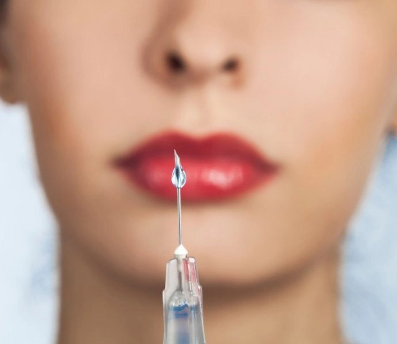 Inyecciones de bótox para tratamiento médico o estético / Foto: EP
