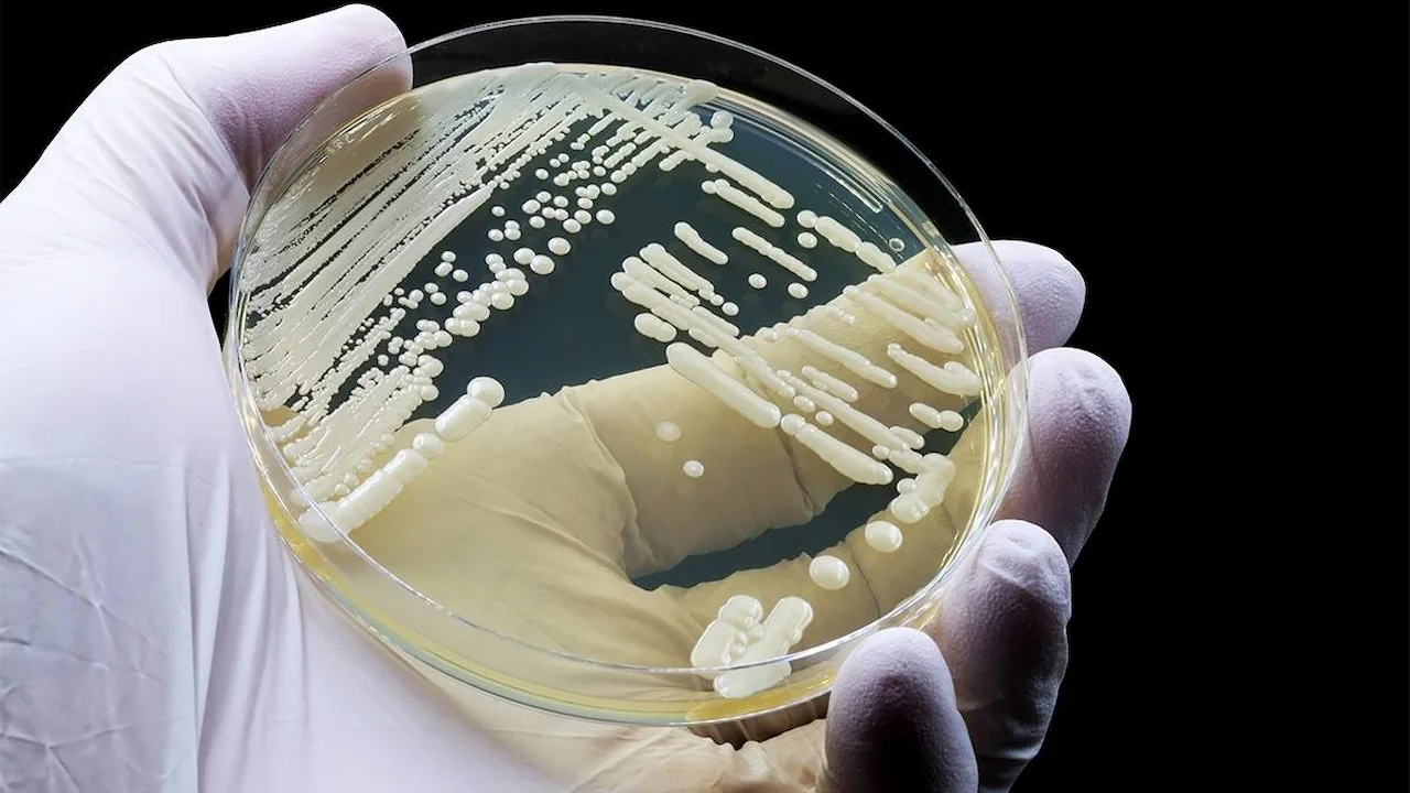'Candidozyma auris' el hongo que surgió del cambio climático / Foto: CDC