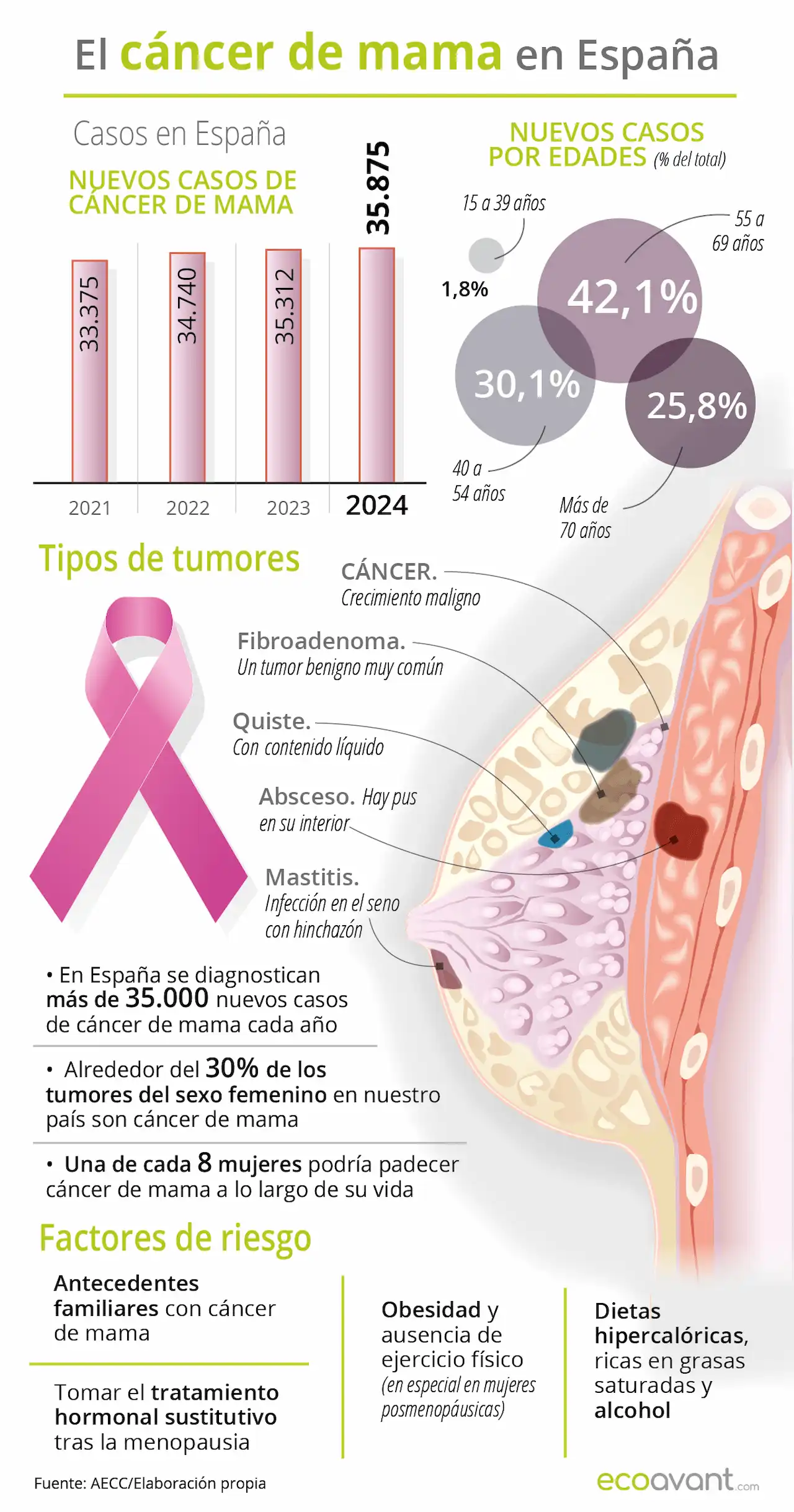 El cáncer de mama en España: cifras y evolución reciente / Infografía: EA