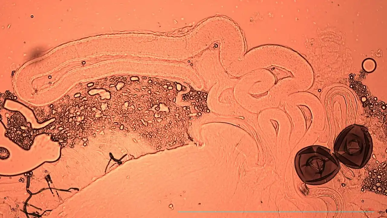 Esperma en las espermatecas (órgano especializado en almacenamiento de esperma a largo plazo) de una mosca hembra de la fruta / Foto: Krish Sangvhi
