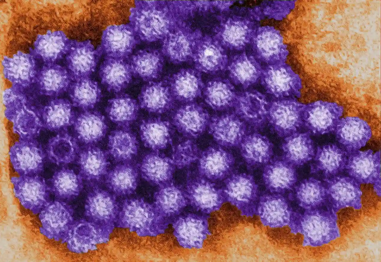 Norovirus visto con microscopía / Imagen: CDC