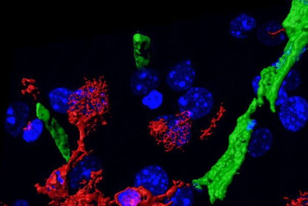 Las células del sistema inmune (rojo) salen de los vasos cerebrales (verde) para infiltrarse en el cerebro de ratones con Alzhéimer / Foto: CNIC