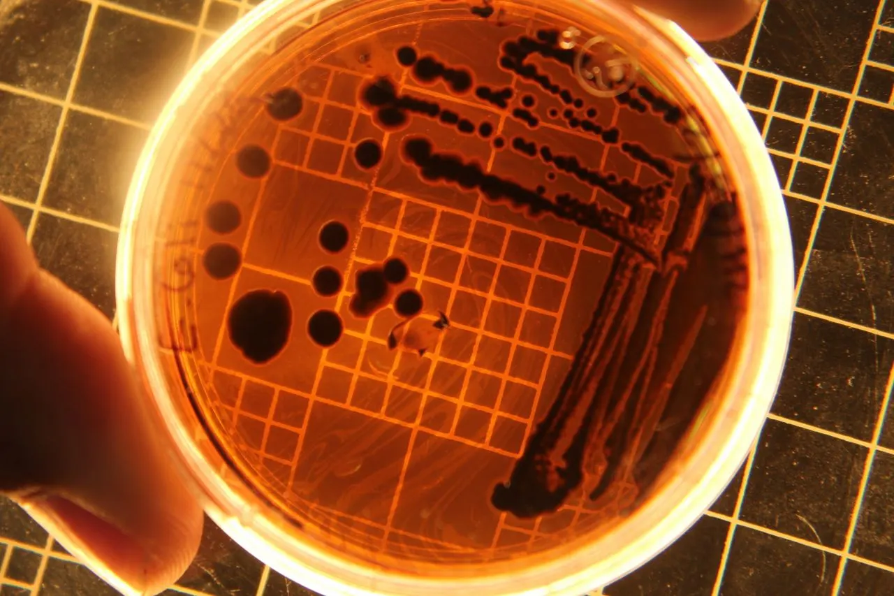 Colonias de bacterias en una placa de Petri en un laboratorio / Foto: PX