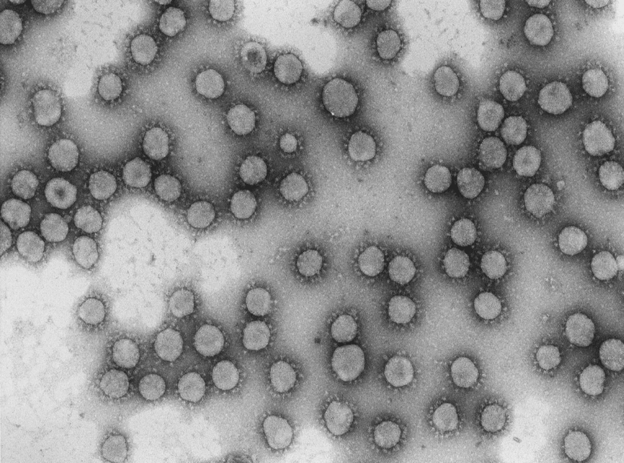 Virus de la familia Coronaviridae / Foto: Luis Enjuanes - CNB / CSIC