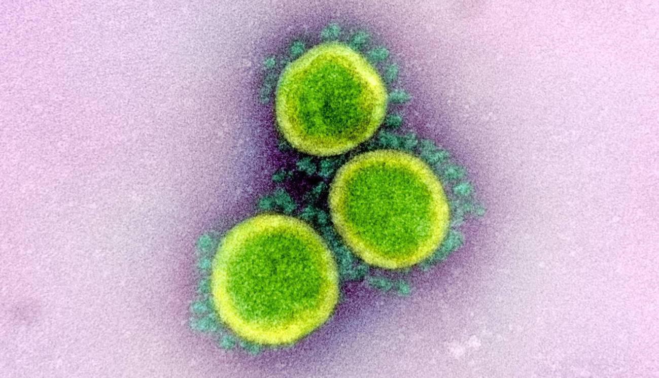 Partículas del virus SARS CoV 2 vistas con el microscopio electrónico de transmisión / Foto: EP