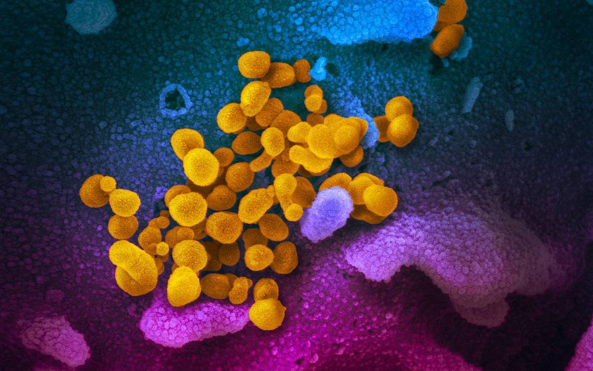 Virus SARS CoV 2 (en amarillo) emergiendo de células (rosadas y azules) cultivadas en el laboratorio, vistos con el microscopio electrónico / Foto:  NIAID RML