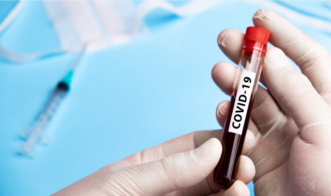 Las dos pruebas combinadas ayudarán a conocer el estado de inmunidad de la población / Foto: Adobe Stock