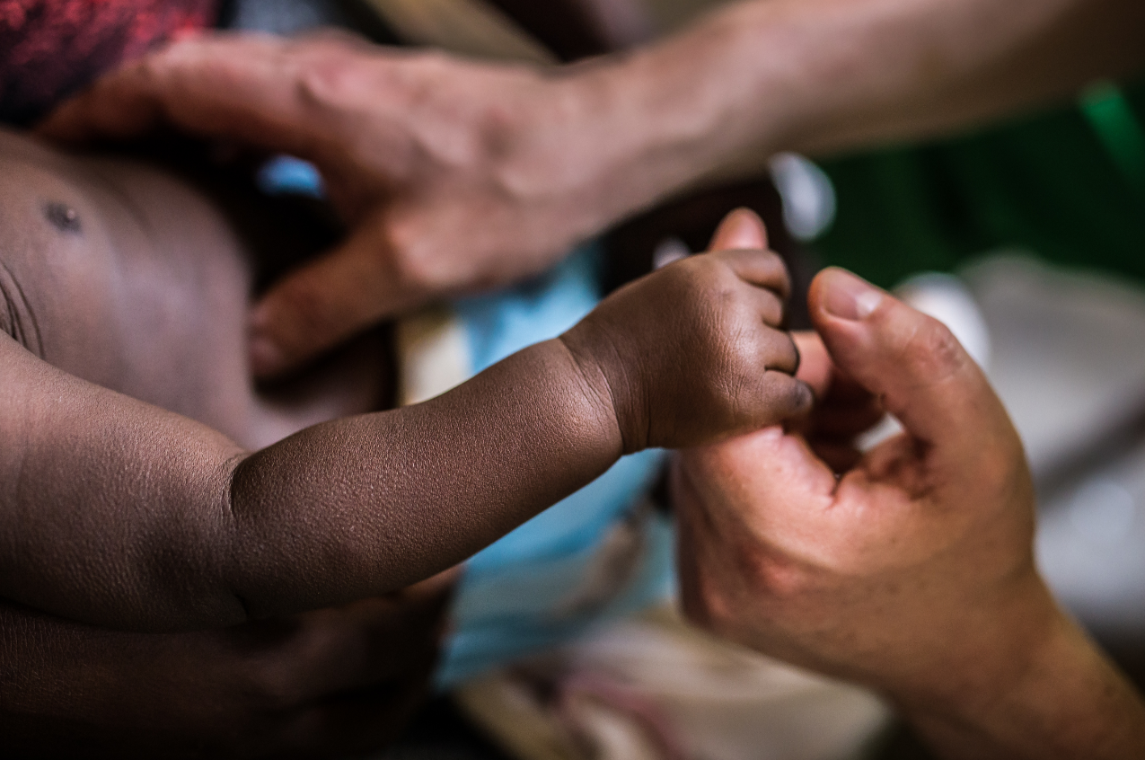 Hoy solo hay poliomielitis en las comunidades más pobres y marginadas, donde acecha a las niñas y a los niños más vulnerables / Foto: SINC