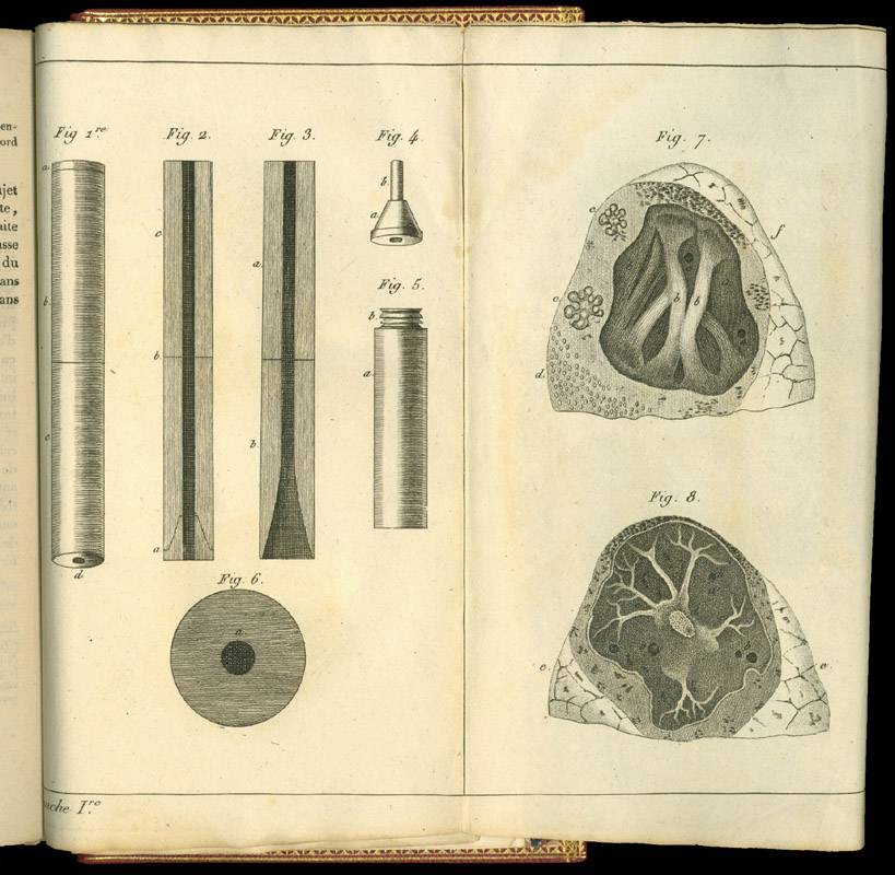 6 Rene Theophile Hyacinthe Laennec1781 1826Drawings stethoscope and lungs (1)