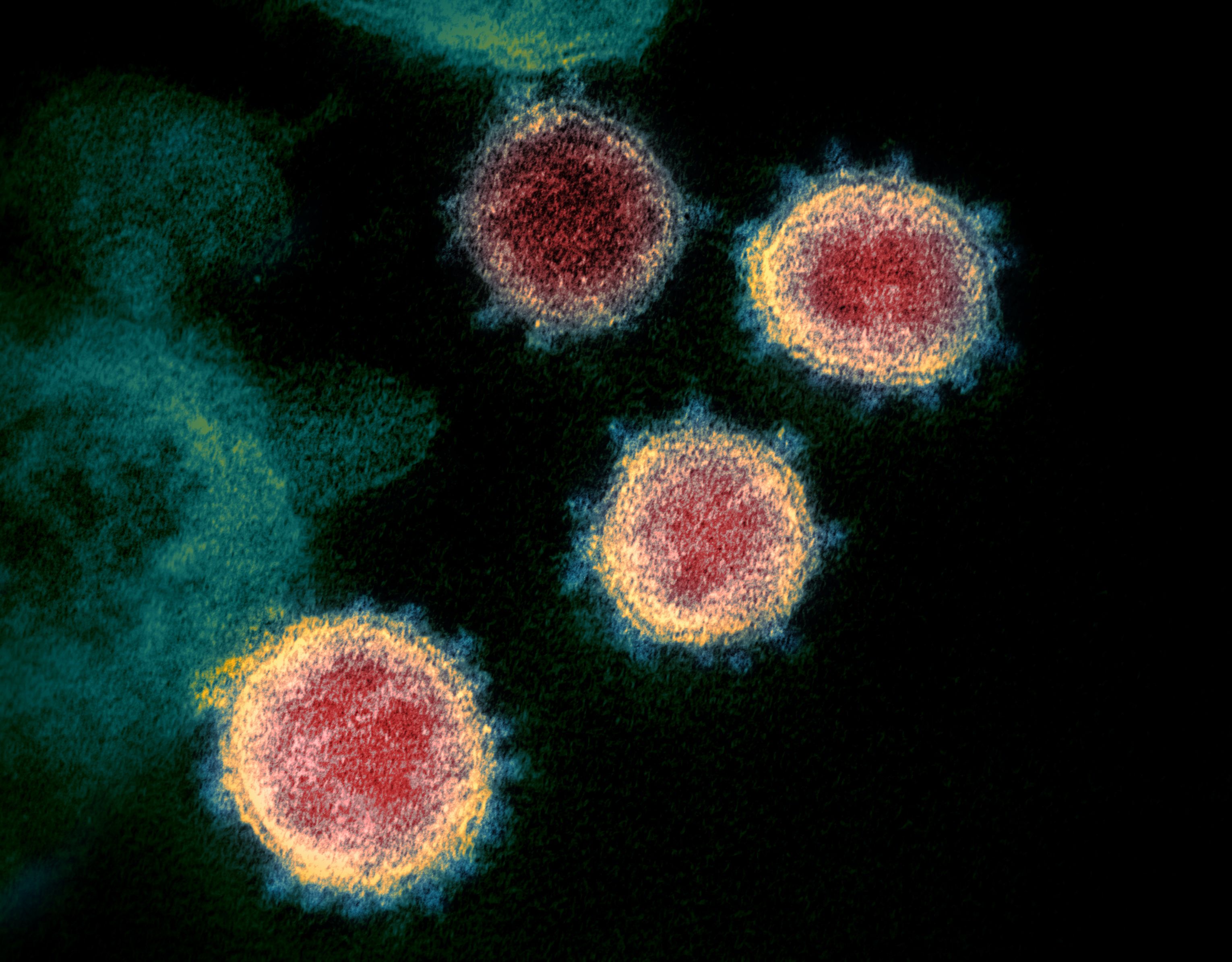 ¿Es más contagioso el SARS-CoV-2 que otros coronavirus? / Imagan: The Conversation