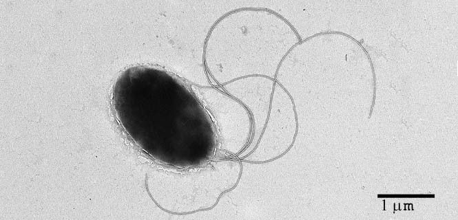 La 'Pseudomonas putida' es muy resistente, pero fácil de manipular. Transforma los plásticos / Foto: CSIC