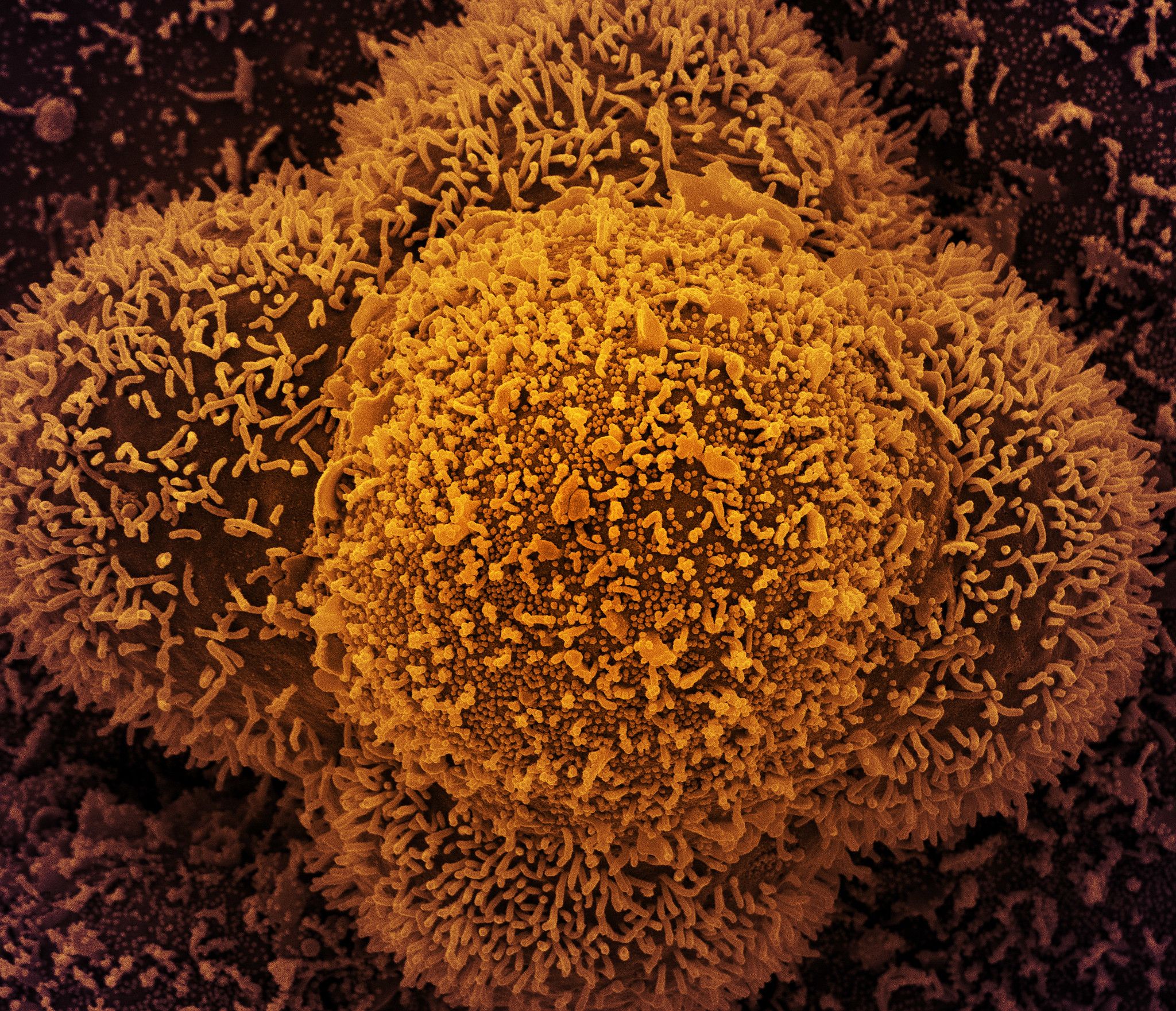 Células CCL-81 (células Vero utilizadas en investigación) fuertemente infectadas con partículas del virus SARS-CoV-2. NIAID / Flickr, CC BY-SA