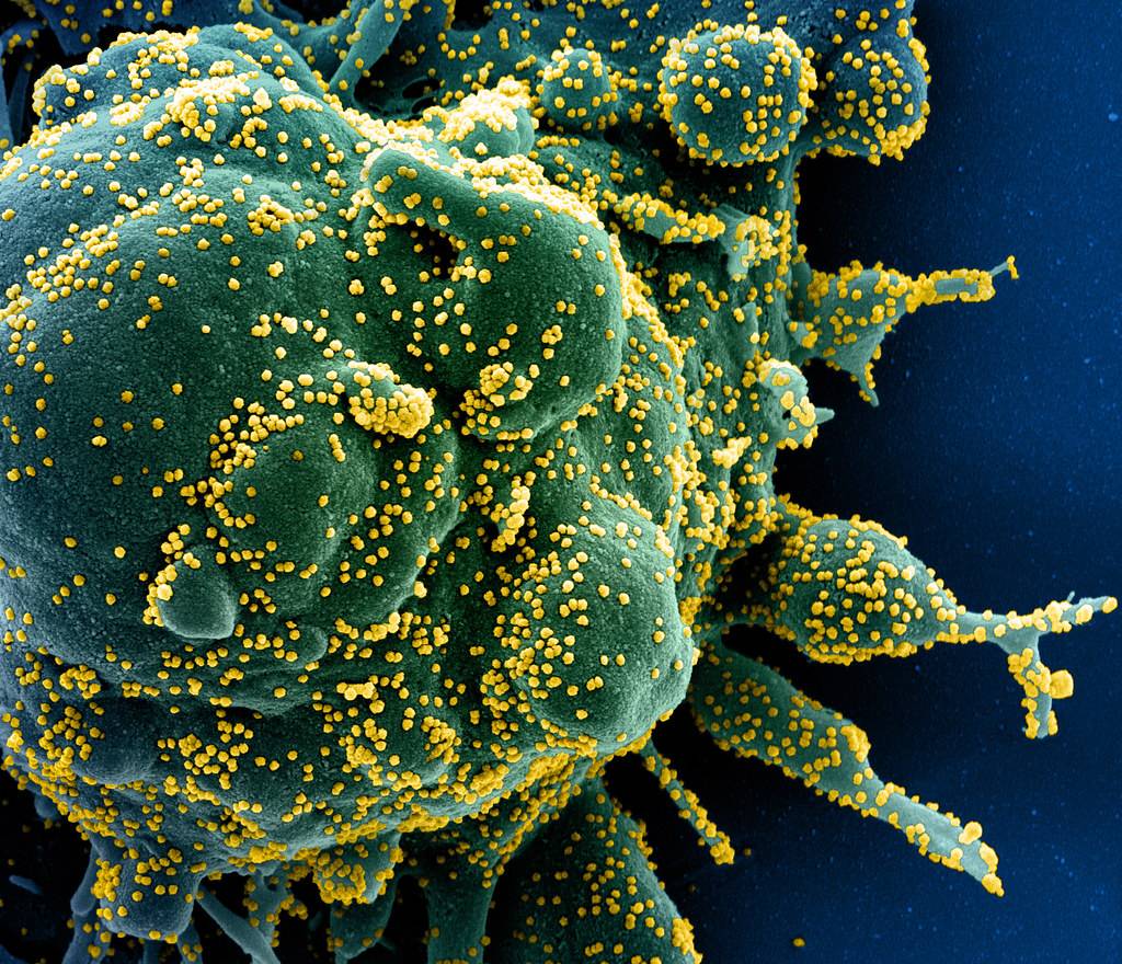 Imagen de microscopio electrónico de transmisión que muestra el SARS-CoV-2, el virus que causa la covid-19, en amarillo. Investigar  el nuevo coronavirus / Imagen: SINC